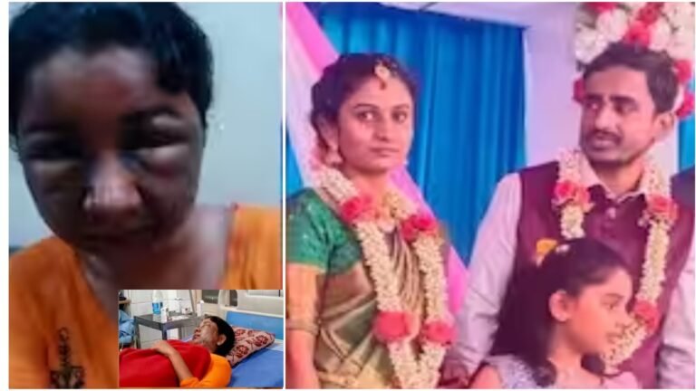 ಮೇಕಪ್ ನಿಂದ ವಿರೂಪಗೊಂಡ ಮುಖ ಸಂಭ್ರಮದಿಂದ ನಡೆಯಬೇಕಿದ್ದ ವಿವಾಹ ನಿಂತು ಹೋಯ್ತು. ಬ್ಯೂಟಿ ಪಾರ್ಲರ್ ಗೆ ಹೋಗೋ ಮಹಿಳೆಯರೇ ಎಚ್ಚರ.!!