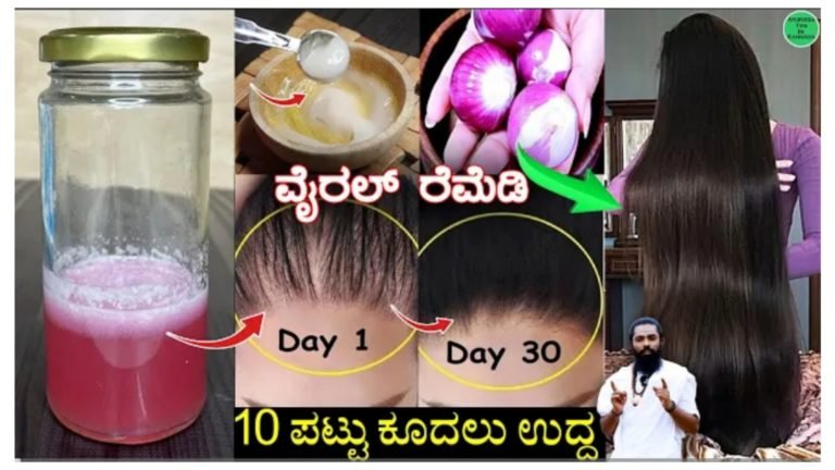 ಕೂದಲು ಉದುರುವಿಕೆ ತಡೆಗಟ್ಟಿ 10 ಪಟ್ಟು ಹೆಚ್ಚು ದಟ್ಟವಾಗಿ ಕೂದಲು ಬೆಳೆಯಲು, ಕೂದಲು ಉದುರುವಿಕೆ ನಿಲ್ಲಲ್ಲು ಮನೆಯಲ್ಲೇ ಈ ಎಣ್ಣೆ ತಯಾರಿಸಿ ಹಚ್ಚಿ 30 ದಿನದಲ್ಲಿ 100% ರಿಸಲ್ಟ್.!