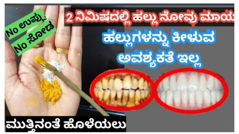 ಎರಡೇ ನಿಮಿಷಗಳಲ್ಲಿ ಹಲ್ಲು ನೋವು, ಬಾಯಿ ದುರ್ವಾಸನೆ, ಮಾಯ ಮಾಡುವ ಅದ್ಭುತ ಮನೆ ಮದ್ದು.!
