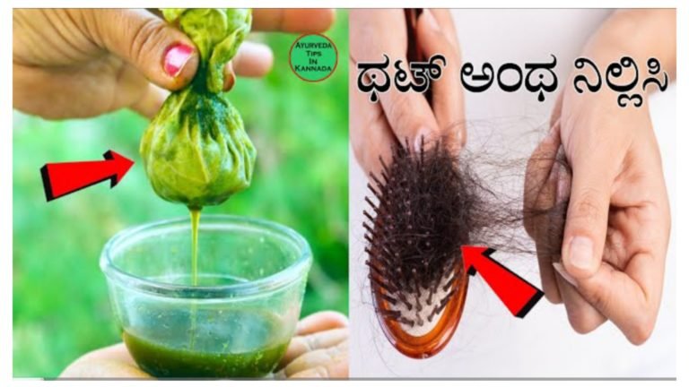 ಕೂದಲು ಉದುರುವ ಸಮಸ್ಯೆ ಇದ್ದವರು ಈ ರಸವನ್ನು ತಲೆಗೆ ಹಚ್ಚಿ ಸಾಕು ಕೂದಲು ಉದುರುವಿಕೆ ಥಟ್ ಅಂತ ನಿಲ್ಲುತ್ತೆ 100% ಫಲಿತಾಂಶ.! ಕೂದಲು ಉದುರುವ ಸಮಸ್ಯೆ ಇದ್ದವರು ಈ ರಸವನ್ನು ತಲೆಗೆ ಹಚ್ಚಿ ಸಾಕು ಕೂದಲು ಉದುರುವಿಕೆ ಥಟ್ ಅಂತ ನಿಲ್ಲುತ್ತೆ 100% ಫಲಿತಾಂಶ.!