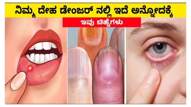 ಈ ಚಿನ್ಹೆಗಳು ಕಂಡು ಬಂದರೆ ನಿಮ್ಮ ದೇಹ ಡೇಂಜರ್ ನಲ್ಲಿ ಇದೆ ಅನ್ನೊದನ್ನು ಸೂಚಿಸುತ್ತದೆ.!