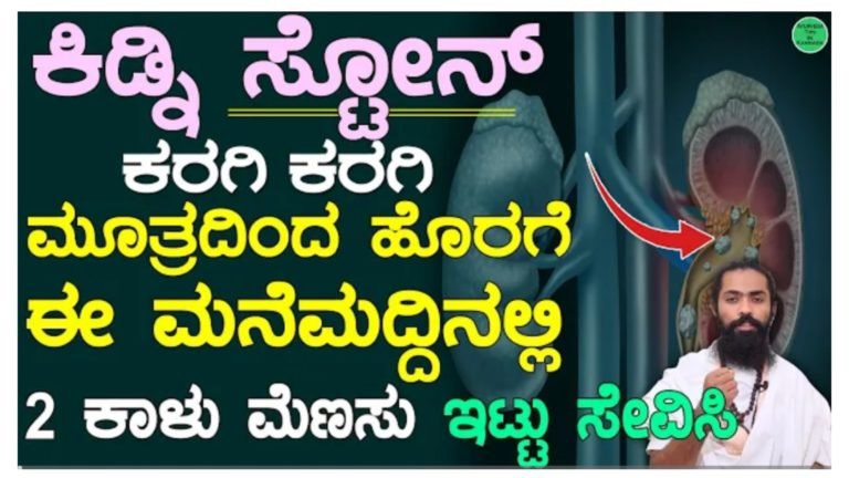 ಕಿಡ್ನಿ ಸ್ಟೋನ್ ಮೂತ್ರದಲ್ಲಿ ಕರಗಿ ಹೋಗುತ್ತೆ.! ಈ ಮನೆಮದ್ದು ಸೇವಿಸಿ ಸಾಕು.! ಕಿಡ್ನಿ ಸ್ಟೋನ್ ಮೂತ್ರದಲ್ಲಿ ಕರಗಿ ಹೋಗುತ್ತೆ.! ಈ ಮನೆಮದ್ದು ಸೇವಿಸಿ ಸಾಕು.!