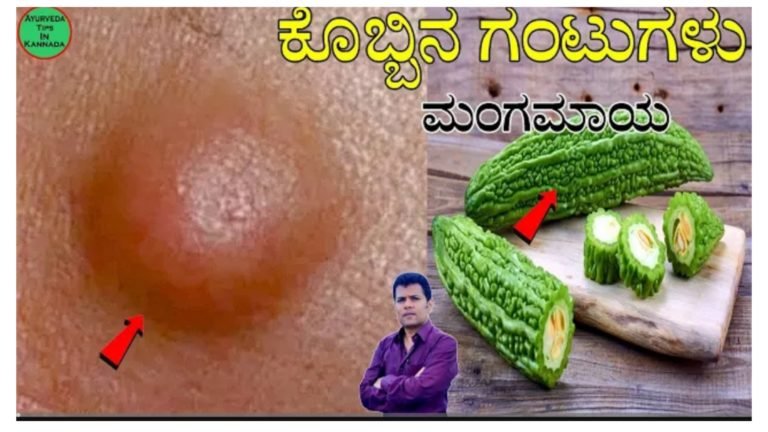 ದೇಹದಲ್ಲಿನ ಕೊಬ್ಬಿನ ಗಂಟುಗಳು ಮಾಯವಾಗಲು ಈ ಮನೆಮದ್ದು ಬಳಸಿ.!