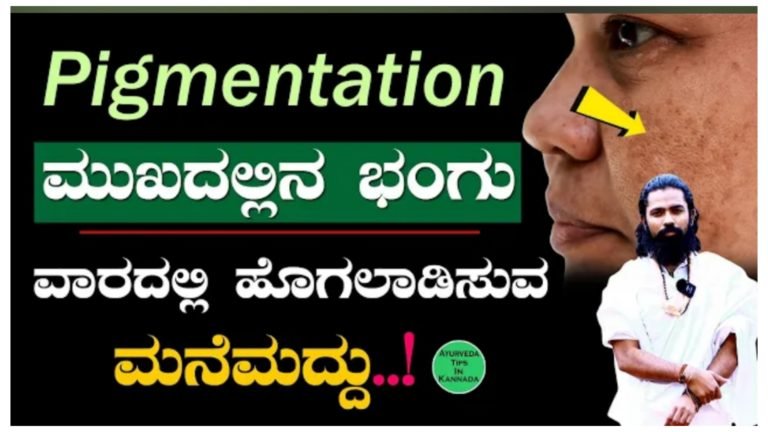 ಕಪ್ಪು ಕಲೆ, ಭಂಗು ಮುಖದಲ್ಲಿ ಎಷ್ಟೇ ಮೊಡವೆ ಇದ್ದರೂ 100% ವಾಸಿಯಾಗುತ್ತೆ.!