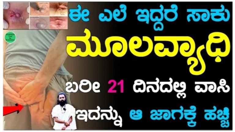 ಈ ಎಲೆಯನ್ನು ಹೀಗೆ ಬಳಸಿ ಸಾಕು ಮೂಲವ್ಯಾಧಿಗೆ 21 ದಿನದಲ್ಲಿ ಶಾಶ್ವತ ಪರಿಹಾರ ಸಿಗುತ್ತೆ.! ಈ ಎಲೆಯನ್ನು ಹೀಗೆ ಬಳಸಿ ಸಾಕು ಮೂಲವ್ಯಾಧಿಗೆ 21 ದಿನದಲ್ಲಿ ಶಾಶ್ವತ ಪರಿಹಾರ ಸಿಗುತ್ತೆ.!