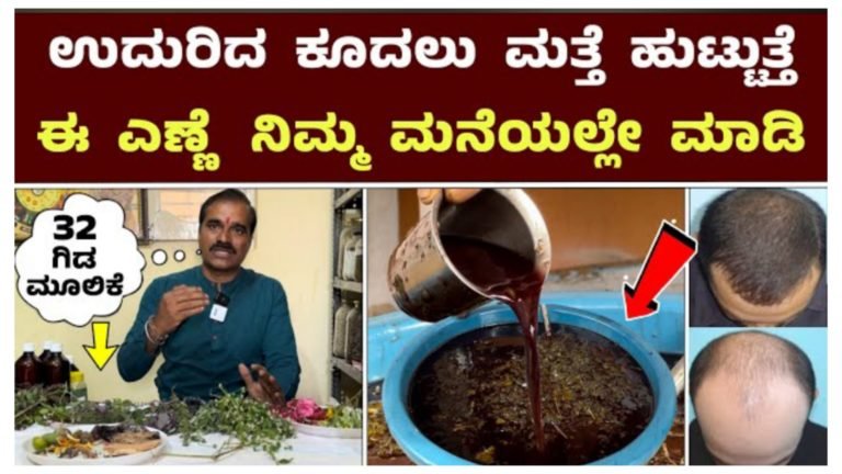 ಈ ಎಣ್ಣೆ ಹಚ್ಚಿದ್ರೆ ಉದುರಿದ ಕೂದಲು ಮತ್ತೆ ಹುಟ್ಟುತ್ತೆ.! ಬಿಳಿ ಕೂದಲ ಸಮಸ್ಯೆಗೆ ರಾಮಬಾಣ.! ಮನೆಯಲ್ಲೇ ತಯಾರಿಸಿ ಈ ನೈಸರ್ಗಿಕ ಎಣ್ಣೆ