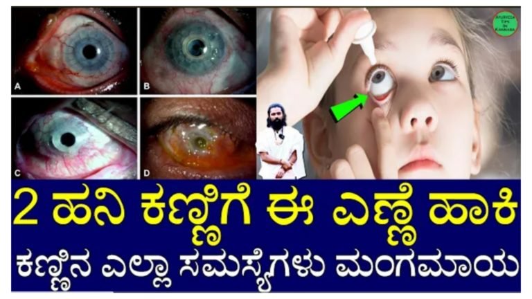 ಎರಡು ಹನಿ ಕಣ್ಣಿಗೆ ಈ ಎಣ್ಣೆ ಹಾಕಿ ನಂತರ ಆಗುವ ಚಮತ್ಕಾರ ನೋಡಿ.! ಎಲ್ಲಾ ರೀತಿಯ ಕಣ್ಣಿನ ಸಮಸ್ಯೆಗೆ ರಾಮ ಬಾಣ ಈ ಎಣ್ಣೆ.!