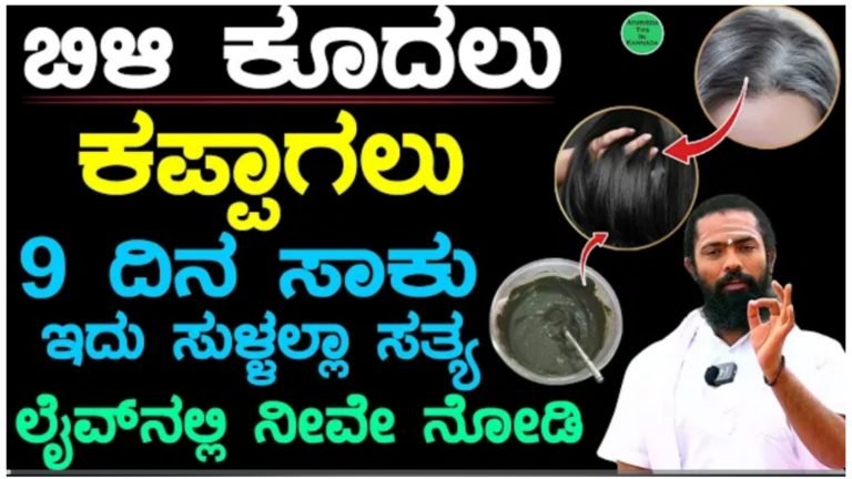 ನಿಮ್ಮ ತಲೆ ಕೂದಲು ನ್ಯಾಚುರಲ್ ಆಗಿ ಬುಡದಿಂದ ಕಪ್ಪಾಗಲು  9 ದಿನ ಈ ರೆಮಿಡಿ ಮಾಡಿ ಸಾಕು.!