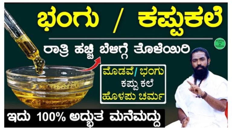 ಮುಖದ ಮೇಲಿನ ಕಪ್ಪು ಕಲೆ / ಭಂಗು ಕ್ಲಿಯರ್ ಮಾಡಲು ಅದ್ಭುತವಾದ ಮನೆ ಮದ್ದು. ರಾತ್ರಿ ಹಚ್ಚಿ ಬೆಳಗ್ಗೆ ಮುಖ ತೊಳೆದರೆ ಸಾಕು .!