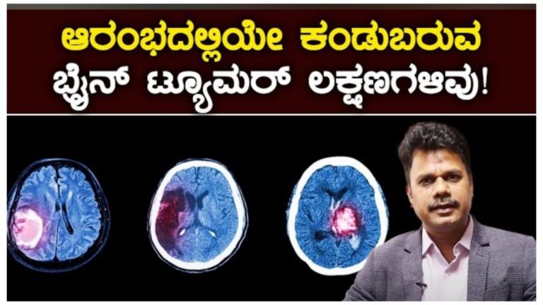 ಆರಂಭದಲ್ಲಿ ಕಂಡು ಬರುವ ಬ್ರೈನ್ ಟ್ಯೂಮರ್ ನ ಲಕ್ಷಣಗಳು ಇವು.! ಈ ಲಕ್ಷಣಗಳು ಇದ್ದರೆ ಎಚ್ಚರ