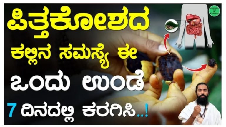 ಪಿತ್ತಕೋಶದ ಕಲ್ಲಿನ ಸಮಸ್ಯೆಗೆ ಅದ್ಭುತ ಪರಿಹಾರ, ಈ ಒಂದು ಉಂಡೆ ಏಳೇ ದಿನಗಳಲ್ಲಿ ಕಲ್ಲು ಕರಗಿಸಿಬಿಡುತ್ತದೆ.!