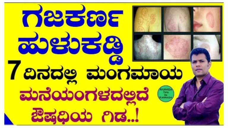 ಗಜಕರ್ಣ, ಕಜ್ಜಿ, ತುರಿಕೆ, ಏಳು ದಿನದಲ್ಲಿ ಮಾಯಾ.!