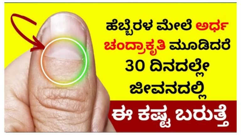 ಹೆಬ್ಬೆರಳ ಉಗುರ ಮೇಲೆ ಅರ್ಧಚಂದ್ರಾಕೃತಿ ಕಂಡರೆ 30 ದಿನಗಳ ಒಳಗೆ ನಿಮ್ಮ ಜೀವನದಲ್ಲಿ ಈ ಘಟನೆ ನಡೆಯುತ್ತದೆ ಎಂದರ್ಥ.