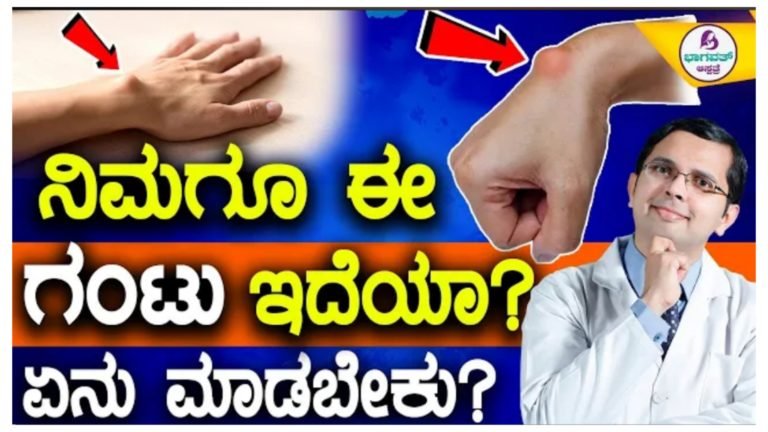 ನಿಮಗೂ ಮೊಣಕೈನಲ್ಲಿ ಈ ರೀತಿ ಗಂಟು ಇದೆಯೇ.? ಕಾರಣ ಏನು.? ಹೀಗಿದ್ದರೆ ಏನು ಮಾಡಬೇಕು ಸಂಪೂರ್ಣ ಮಾಹಿತಿ ಇಲ್ಲಿದೆ ನೋಡಿ.!