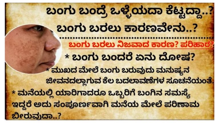 ಬಂಗು ಬಂದ್ರೆ ಒಳ್ಳೆಯದಾ ಕೆಟ್ಟದ್ದಾ..? ಬಂಗು ಬರಲು ಕಾರಣವೇನು..? ಬಂಗು ಬಂದರೆ ಏನು ದೋಷ.! ಸಂಪೂರ್ಣ ಮಾಹಿತಿ ಇಲ್ಲಿದೆ ನೋಡಿ.! ಬಂಗು ಬಂದ್ರೆ ಒಳ್ಳೆಯದಾ ಕೆಟ್ಟದ್ದಾ..? ಬಂಗು ಬರಲು ಕಾರಣವೇನು..? ಬಂಗು ಬಂದರೆ ಏನು ದೋಷ.! ಸಂಪೂರ್ಣ ಮಾಹಿತಿ ಇಲ್ಲಿದೆ ನೋಡಿ.!